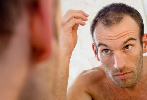 hair regrow in bald head